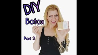 DIY Botox Part 2 Mapping Where do I Inject