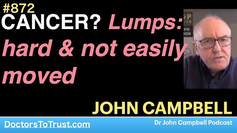 JOHN CAMPBELL 3 | CANCER? Lumps: hard & not easily moved