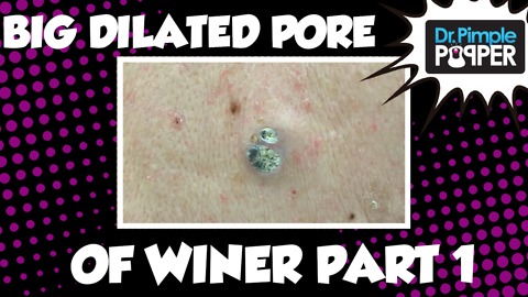 Dr Pimple Popper: BIG DPOW with Dr. Pimple Popper