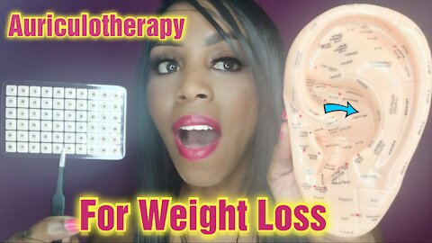 Auriculotherapy for Weight Loss | Ear seeds (acupuncture)