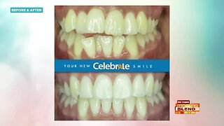 Celebrate Your Smile