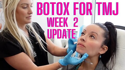 BOTOX for TMJ Week 2 Update