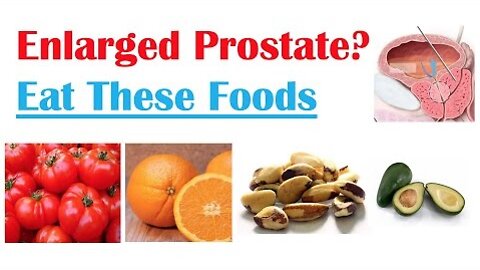 Best Foods to Eat with Enlarged Prostate | Reduce Risk of Symptoms, Enlargement & Cancer