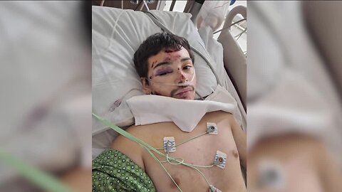 Teen recovering from major injuries after getting hit by RTD bus