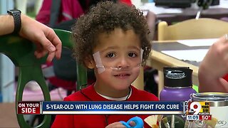 Alexandria 5-year-old inspires fundraiser for lung disease research