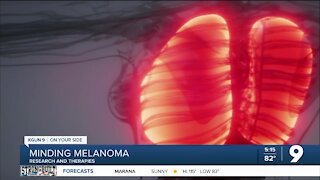 Minding Melanoma: Research and therapies