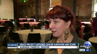 Grace Project captures breast cancer survivors and scars
