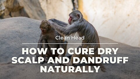 how to cure dry scalp and dandruff naturally