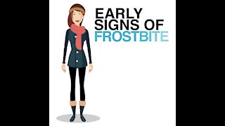 Early Signs Of Frosbite [GMG Originals]