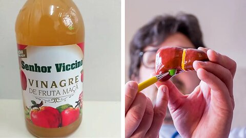 Descubra o poder do vinagre de maçã para a saúde da sua vesícula!