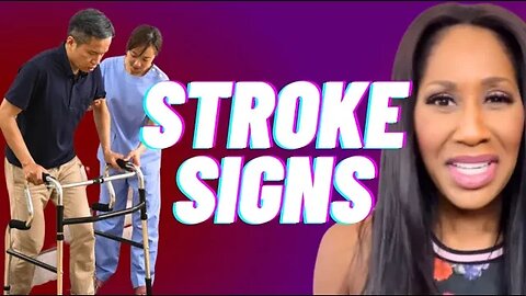 What Are the Early Warning Signs of a Stroke? What Are Stroke Symptoms? A Doctor Explains