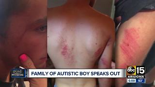 Valley mother speaks out after teen with autism detained by police
