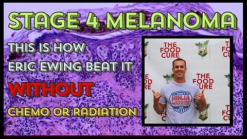 Stage 4 Melanoma: How Eric Ewing Beat It Without Chemo or Radiation