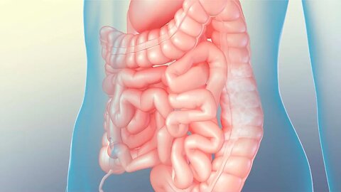 Understanding Lactose Intolerance