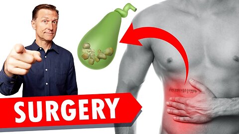 Gallbladder Surgery (Removal): WATCH THIS!