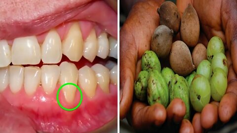 ESTAS 3 FRUTAS PODEM RESOLVER A MAIORIA DOS SEUS PROBLEMAS DE GENGIVA E DENTES