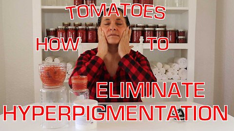 TOMATOES | HOW TO ELIMINATE HYPERPIGMENTATION | WITH SKIN & ANTI-AGING EXPERT VIVIAN MORENO