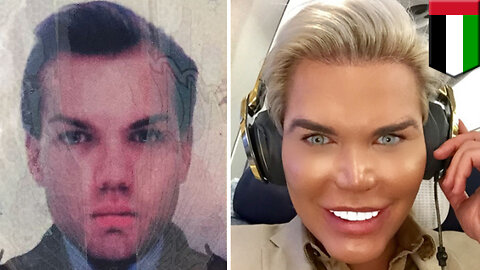 Plastic surgery: Human Ken doll held in Dubai for iffy passport pic; wants to be Barbie - TomoNews