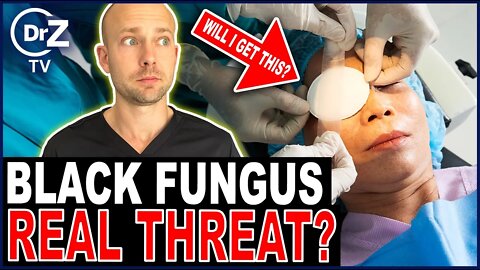 Is BLACK FUNGUS The Next Pandemic? - Doctor Reacts!