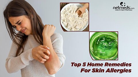 Skin allergy causes, symptoms and home remedies. (Urdu)