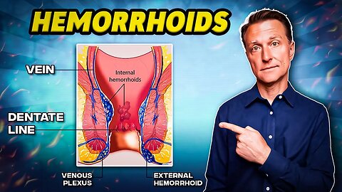 The #1 Best Remedy for Hemorrhoids - Dr. Berg