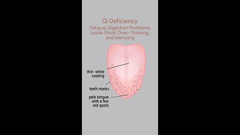 Tongue Mapping