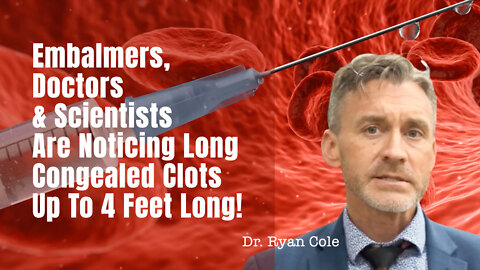Embalmers, Doctors & Scientists Are Noticing Long Congealed Clots Up To 4 Feet Long!