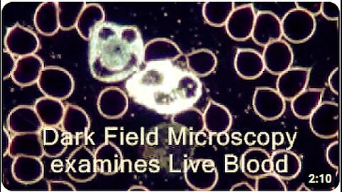 Live Blood Analysis Dark Field Microscopy explained like never before