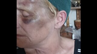 Imperial Beach grandmother punched in road rage attack