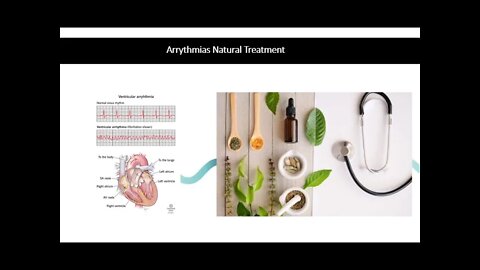 Arrythmias Natural Treatment