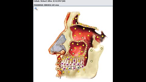 Bad Breath Natural Recovery Update Sun April 24th 2022