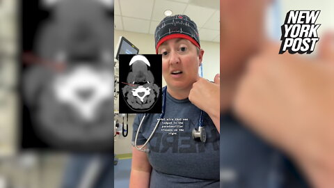 Florida doctor issues BBQ grill brush warning after child's visit to emergency room