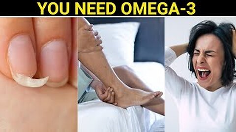 10 Signs Your Body Is Begging For Omega-3