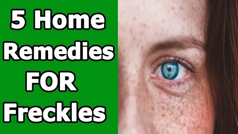 5 Home Remedies To Get Rid of Freckles Fast