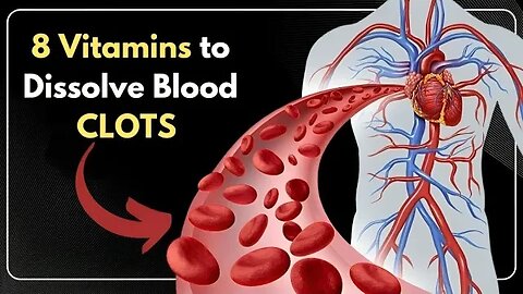 8 Vitamins That Help Dissolve Blood Clots in Your Body in 2023