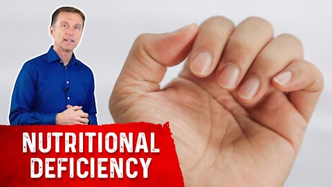 Your Nails Help Diagnose Nutrient Deficiencies