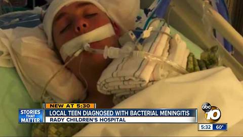 Local teen diagnosed with bacterial meningitis