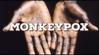 MonkeyPox Special With Pastor Anthony