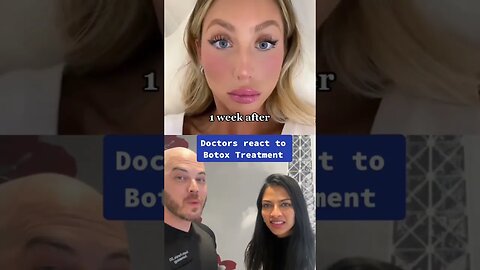 Doctors react to Alix Earle’s botox treatment! #botox