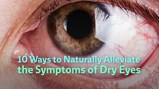 10 Ways to Naturally Alleviate the Symptoms of Dry Eyes