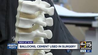 Spinal surgery using balloons and cement helps Valley woman stay active