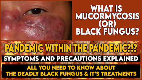 What is Mucormycosis (or) Black Fungus? | Why Covid patients are at risk? | Completely Explained