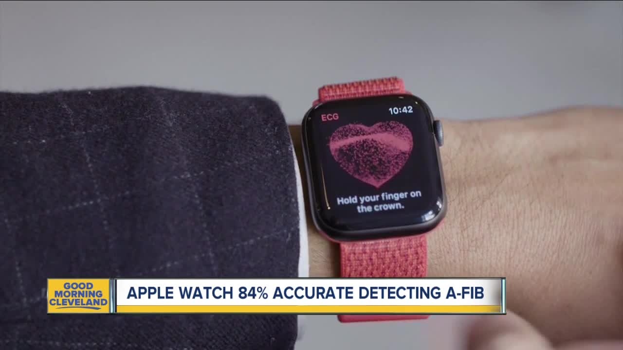 Apple Watch scores well detecting irregular heartbeats