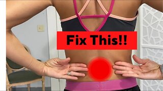 Fix Your Low Back Bulging Disc Without Surgery