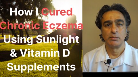 How I Cured Chronic Eczema Using Sunlight & Vitamin D Supplements