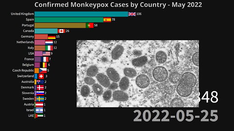 Monkeypox Cases by Country | May 2022
