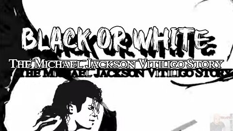 Black Or White: The Michael Jackson Vitiligo Story