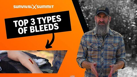 The 3 Different TYPES OF BLEEDS