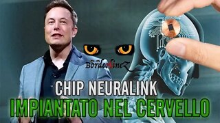 Chip Neuralink impiantato sul cervello umano. Elon Musk: "sarà fatto nei prossimi sei mesi"