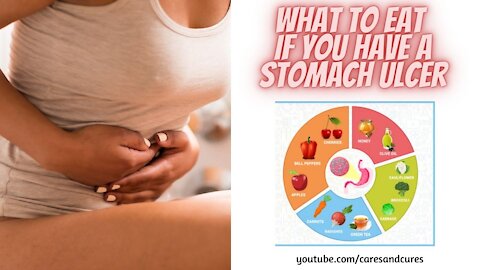 Stomach Ulcer Diet | Ulcers Diet | Treat A Stomach Ulcer |Stomach Ulcer What To Eat | Stomach Ulcers